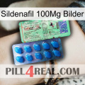 Sildenafil 100Mg Images new02